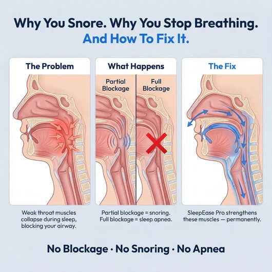 Sleep Pro — Eliminates Snoring & Sleep Apnea